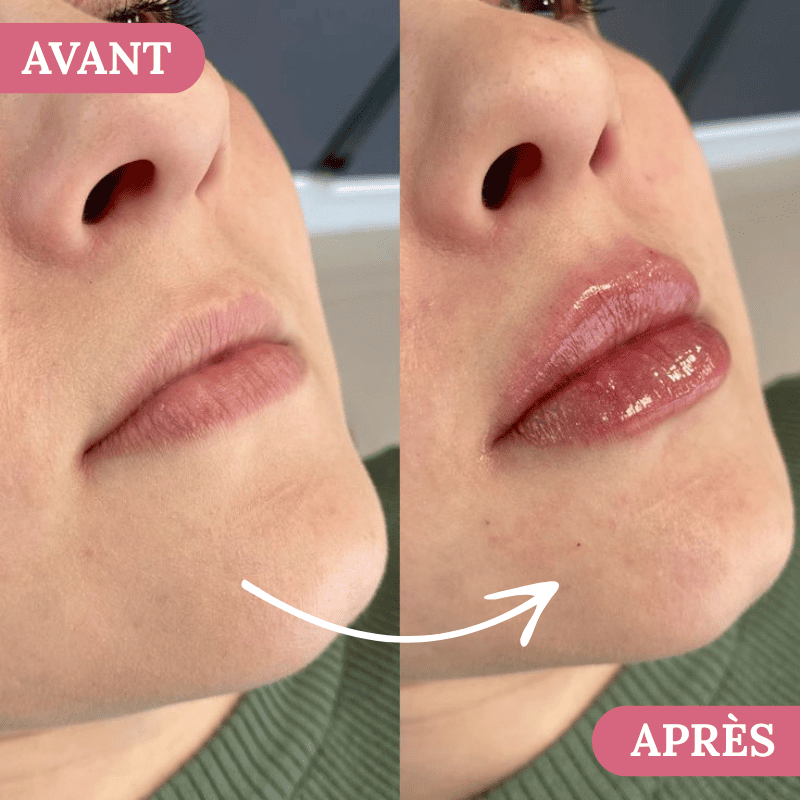 Velour Lip Kit