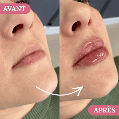 Velour Lip Kit