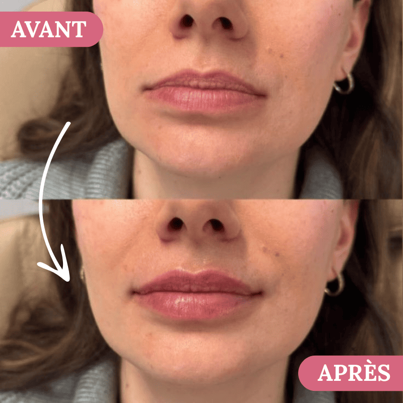 Velour Lip Kit