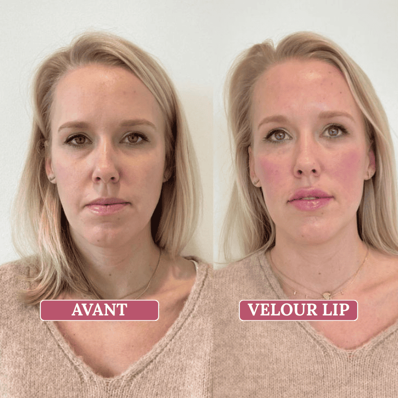 Velour Lip Kit