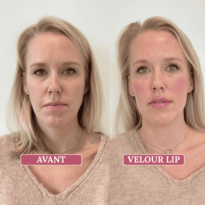 Velour Lip Kit