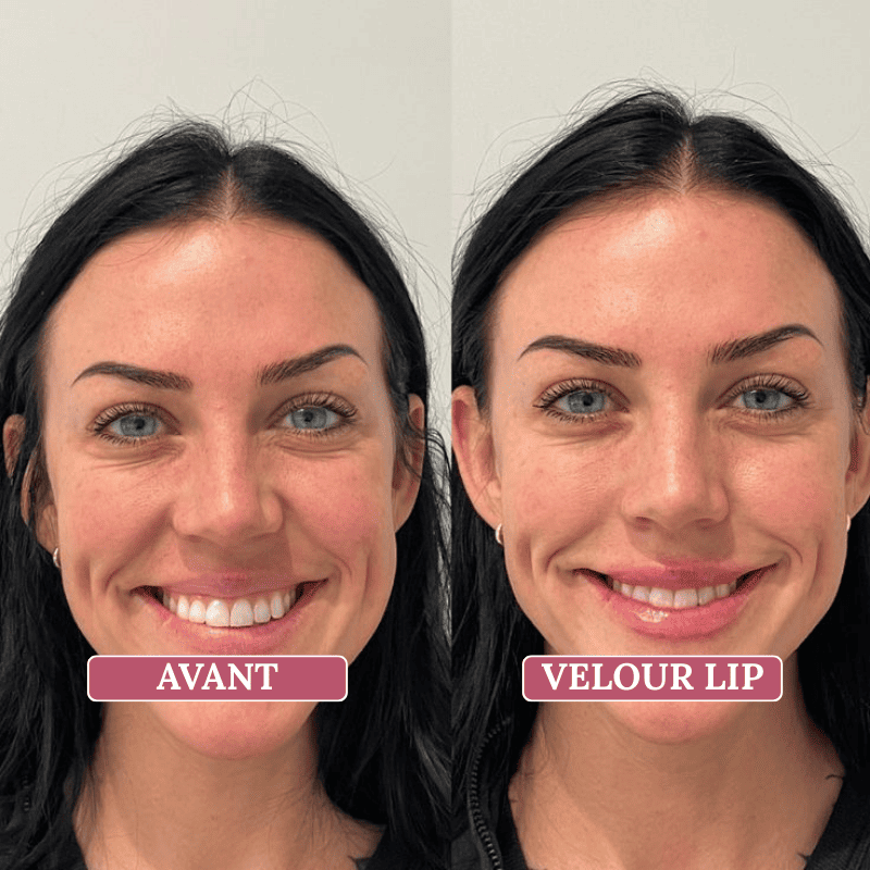 Velour Lip Kit