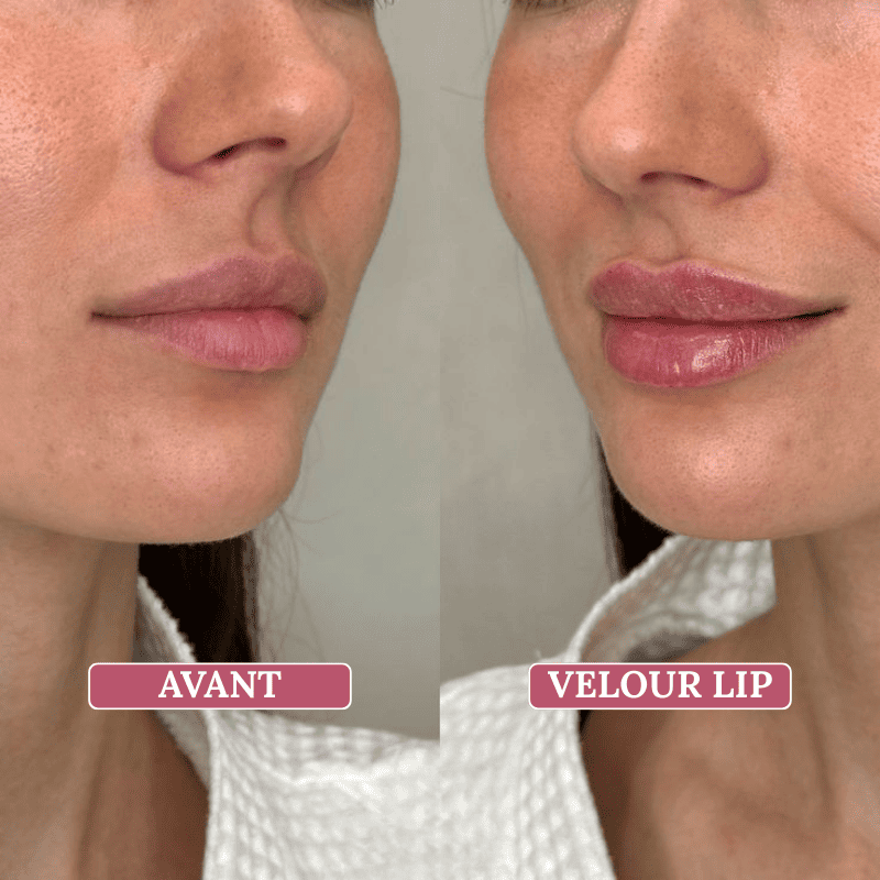 Velour Lip Kit