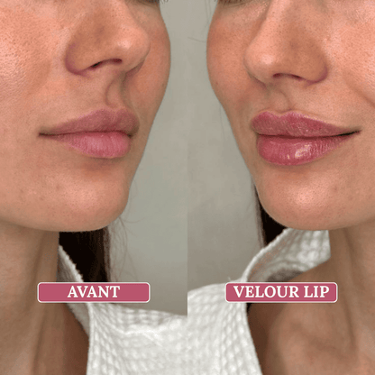 Velour Lip Kit